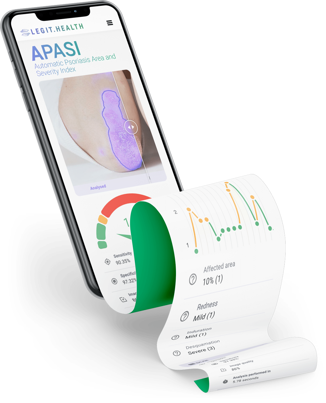 Legit.Health app running APASI: automatic psoriasis severity scoring from a single clinical image, with structured output in under 6 seconds